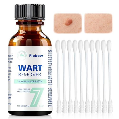 30ML Líquido para cuidado de la piel, Profesional Mejorad de Piel áspera, las protuberancias de la piel, Fácil De Usar, para La Mayoría de Las Partes Del Cuerpo, para Cara, cuello, manos y pies