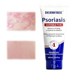 100ml Crema Anti-Picazón,Crema Reparadora,Para El Cuidado,crema Humectante,para pieles secas y Picor,Nutre la Piel y Hidratación